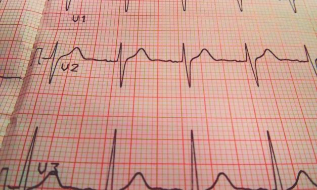 BRANDIZZO – Gli Ecg alla Casa della Salute